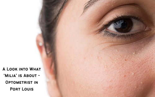 A Look into What ‘Milia’ is About - Optometrist in Port Louis